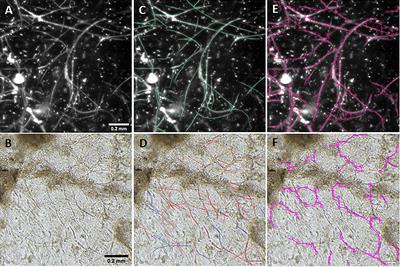 Quantifying Vascular Density in Tissue Engineered Constructs Using Machine Learning